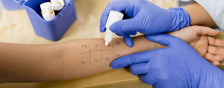 Allergy Testing Services