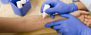 Allergy Testing Services