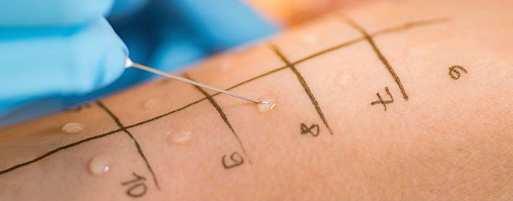 Allergy Testing Clinic in Conyers, GA Allergy Testing Clinic in Conyers, GA