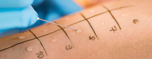 Allergy Testing Clinic in Conyers, GA