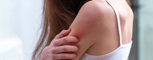 Eczema Treatment Questions and Answers Eczema Treatment Questions and Answers