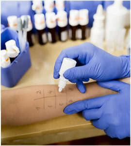 Allergy Testing Services