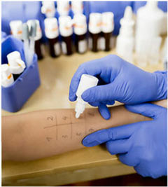 Allergy Testing Services