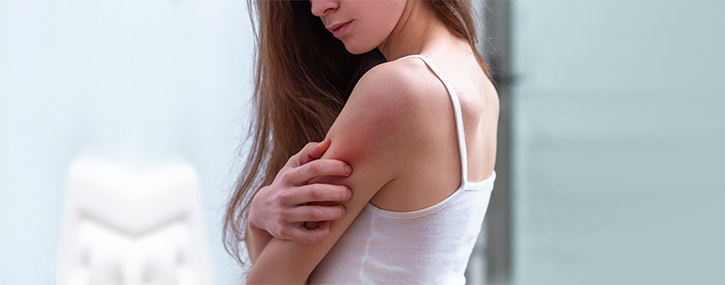 Skin Allergy Test Near Me in Lawrenceville GA, Atlanta GA, and Conyers GA