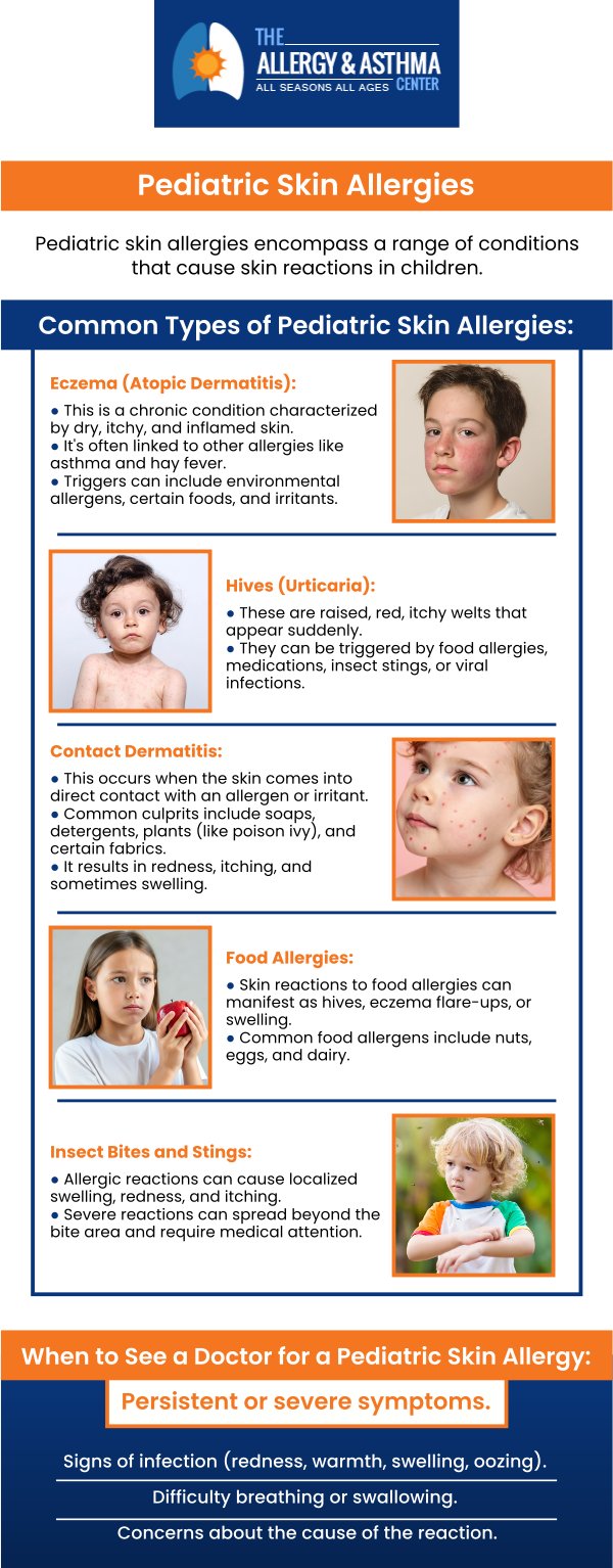 Pediatric skin allergies often show themselves as a rash, and are often accompanied by other symptoms. If your child is dealing with a rash and you think it may be associated with allergies, visit Allergy & Asthma Center! For more information, contact us or book an appointment online. We have convenient locations to serve you in Lawrenceville GA, Atlanta GA and Conyers, GA. Pediatric skin allergies often show themselves as a rash, and are often accompanied by other symptoms. If your child is dealing with a rash and you think it may be associated with allergies, visit Allergy & Asthma Center! For more information, contact us or book an appointment online. We have convenient locations to serve you in Lawrenceville GA, Atlanta GA and Conyers, GA.