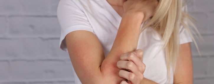 What Are the Best Treatments for Allergy Rashes? | The Allergy & Asthma Center in Lawrenceville, GA, Atlanta, GA and Conyers, GA What Are the Best Treatments for Allergy Rashes? | The Allergy & Asthma Center in Lawrenceville, GA, Atlanta, GA and Conyers, GA