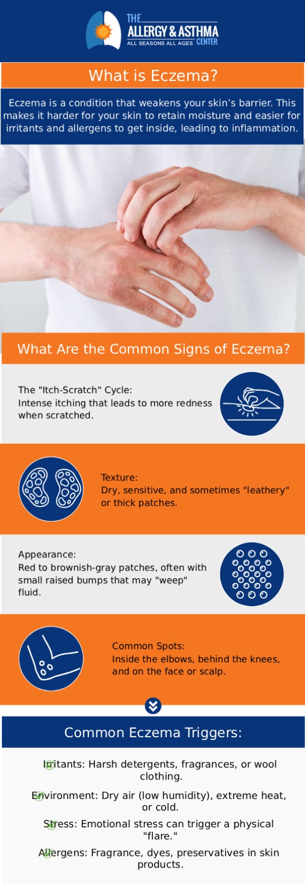 Are you experiencing an eczema flare-up? Dr. Jon E. Stahlman, MD, and his team at The Allergy & Asthma Center will help treat your eczema. For more information, contact us or book an appointment online. We have 3 convenient locations to serve you in Lawrenceville GA, Atlanta GA, and Conyers GA. Are you experiencing an eczema flare-up? Dr. Jon E. Stahlman, MD, and his team at The Allergy & Asthma Center will help treat your eczema. For more information, contact us or book an appointment online. We have 3 convenient locations to serve you in Lawrenceville GA, Atlanta GA, and Conyers GA.