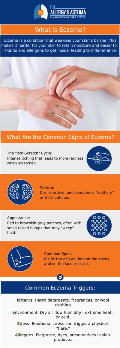 Are you experiencing an eczema flare-up? Dr. Jon E. Stahlman, MD, and his team at The Allergy & Asthma Center will help treat your eczema. For more information, contact us or book an appointment online. We have 3 convenient locations to serve you in Lawrenceville GA, Atlanta GA, and Conyers GA. Are you experiencing an eczema flare-up? Dr. Jon E. Stahlman, MD, and his team at The Allergy & Asthma Center will help treat your eczema. For more information, contact us or book an appointment online. We have 3 convenient locations to serve you in Lawrenceville GA, Atlanta GA, and Conyers GA.