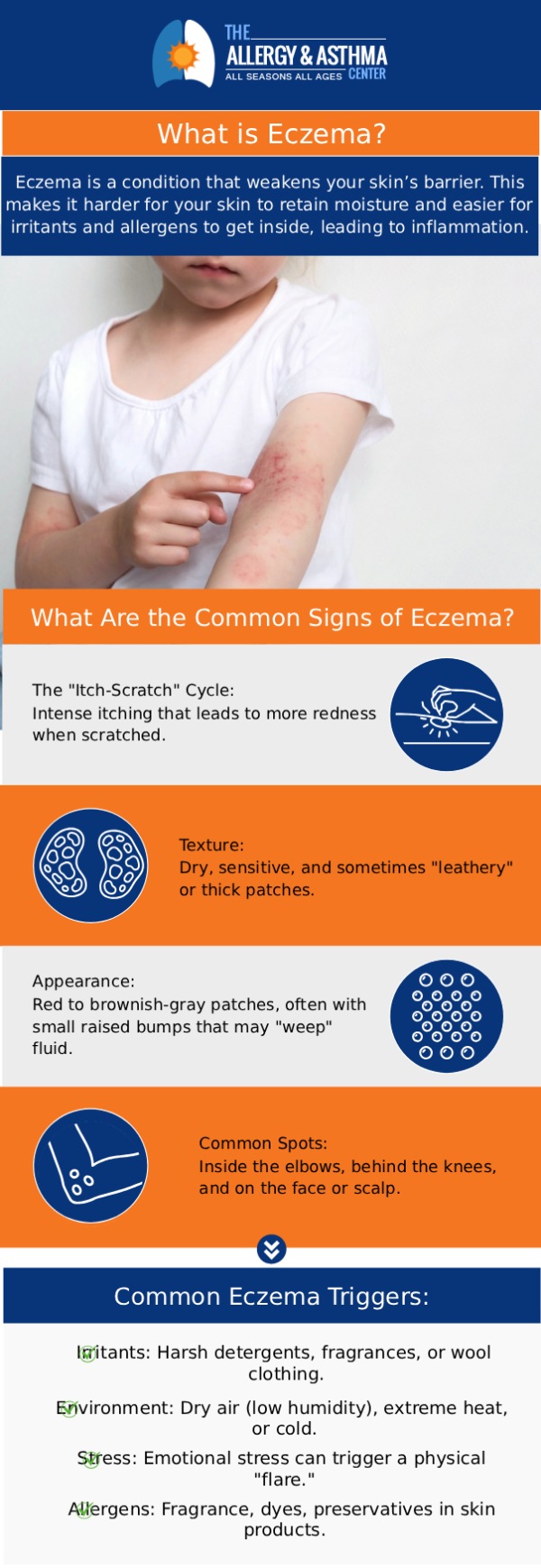 At the Allergy & Asthma Center, our board-certified allergists, Dr. Jon E. Stahlman, MD, and Dr. Deidre D. Crocker, MD, and the team conduct a skin prick test or a blood test to identify the allergens causing your child's eczema. If your child is under the age of five and has moderate to severe eczema symptoms, you should have them tested for allergies to identify what is causing their eczema. If the allergy test results are positive, our specialists will design a treatment and management plan to alleviate the symptoms. For more information, please contact us or book an appointment online. We are conveniently located at 1755 Parker Rd, Suite A120 Conyers, GA, 30094.